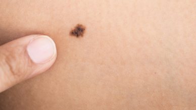 Doenças da Pele, Unhas e Cabelos 126 Doenças da Pele, Unhas e Cabelos 11