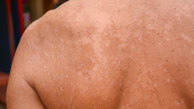 Doenças da Pele, Unhas e Cabelos 131 Doenças da Pele, Unhas e Cabelos 16