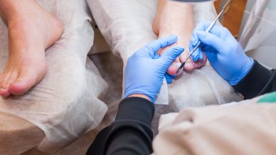 Doenças da Pele, Unhas e Cabelos 139 Doenças da Pele, Unhas e Cabelos 24