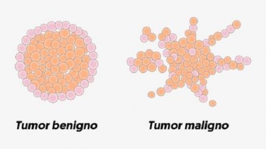 Doenças Neurológicas 48 Doenças Neurológicas 17